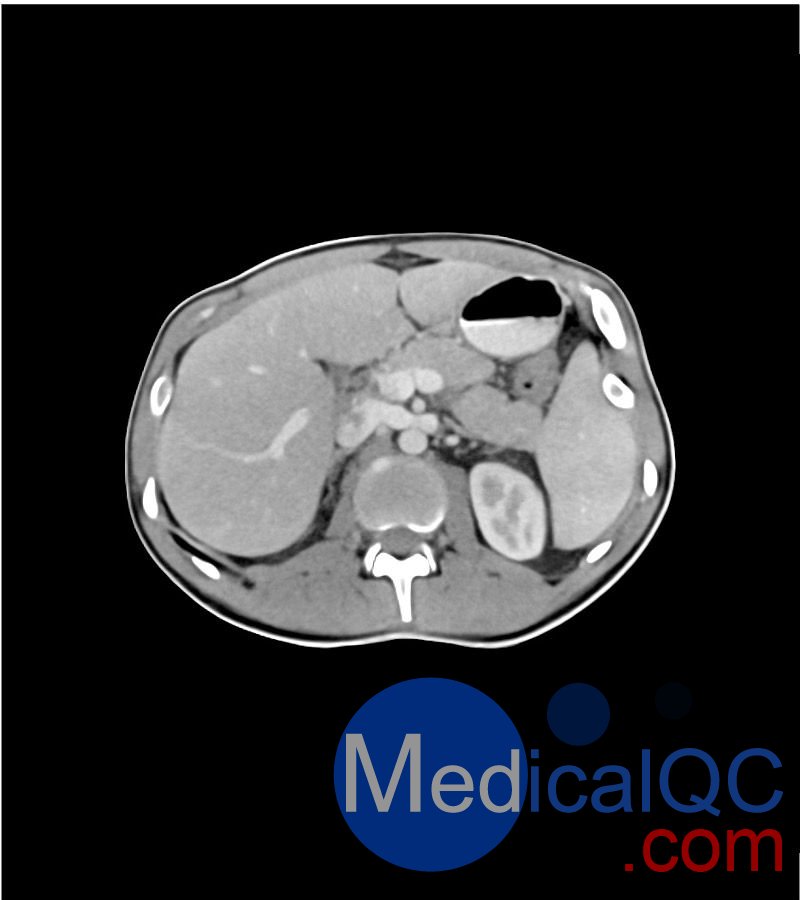 WEK-5501男性腹部模体，WEK-5501男性骨盘模体