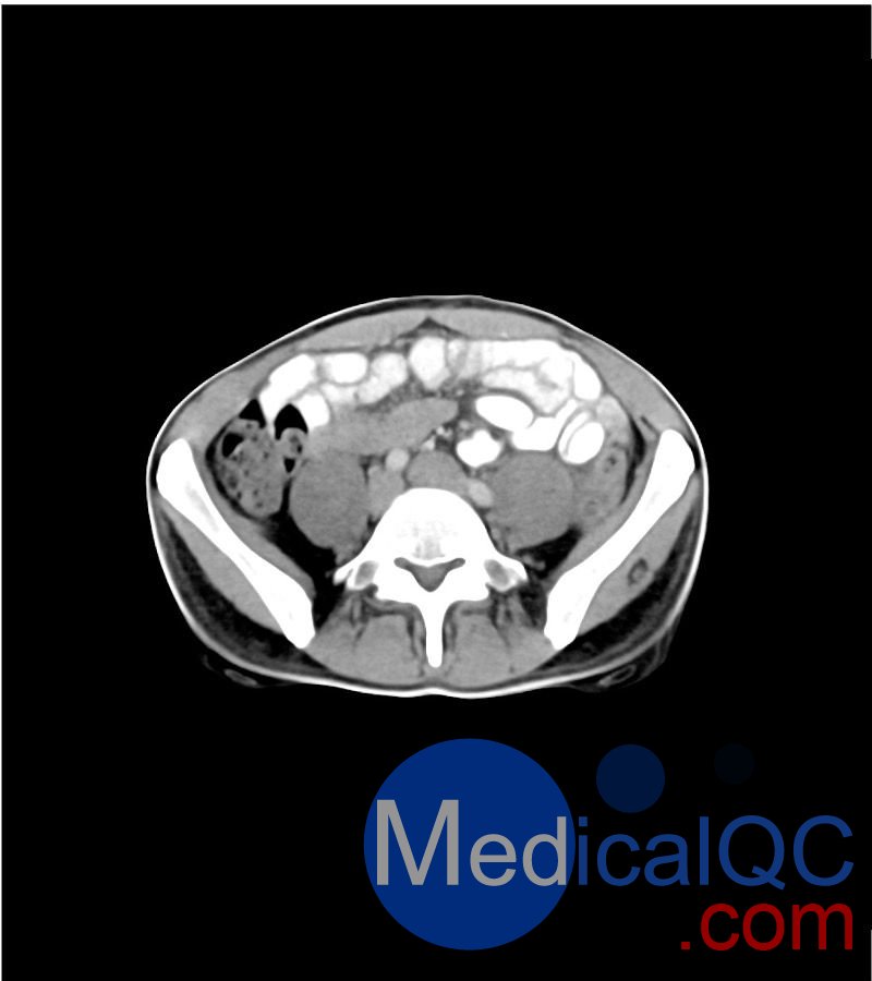 WEK-5501男性腹部模体，WEK-5501男性骨盘模体