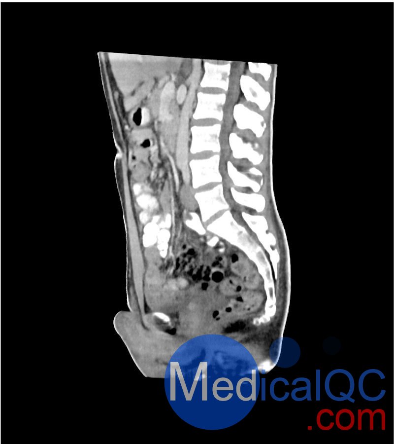 WEK-5501男性腹部模体，WEK-5501男性骨盘模体