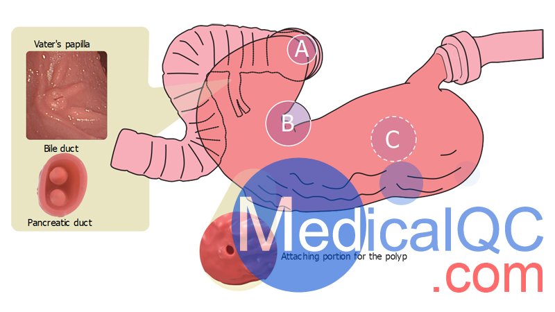 LM-103胃肠镜模拟器，LM-103胃肠模体，EGD模拟器