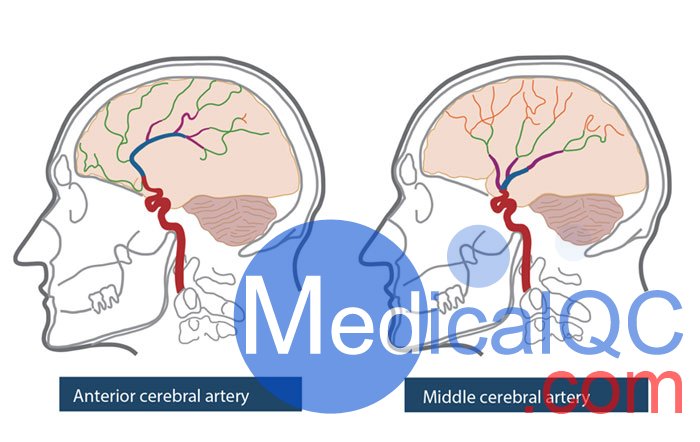 PH-3 ACS头部模型,PH-3 CT头部模体，PH-3血管造影头模