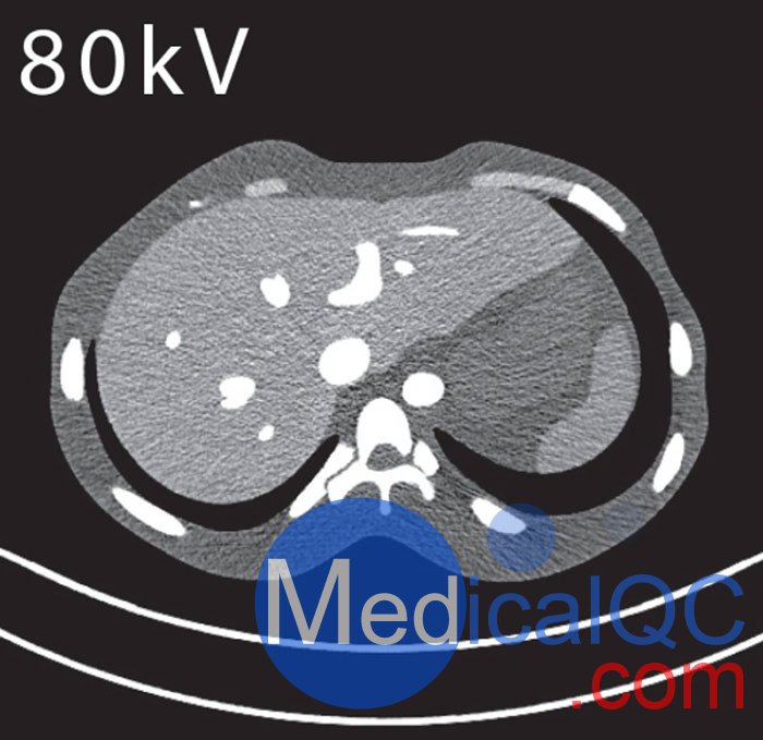 PH-5 CT腹部模体，CT腹部模型PH-5,PH-5多能CT腹部模体成像效果图