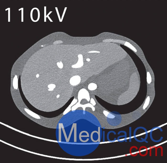 PH-5 CT腹部模体，CT腹部模型PH-5,PH-5多能CT腹部模体成像效果图