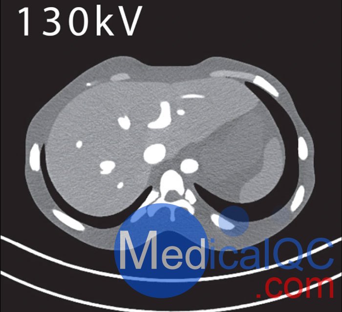 PH-5 CT腹部模体，CT腹部模型PH-5,PH-5多能CT腹部模体成像效果图